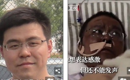 Уханьда коронавирустан терісі қарайып кеткен дәрігер көз жұмды - Қазақстан жаңалықтары