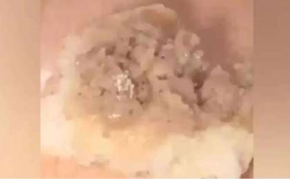 Жетісуда мектеп асханасындағы самсадан ақ құрттар шықты