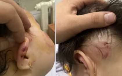 Балабақшада бір жарым жасар қызды ұрып-соқты: Оқиғаға қатысты мәліметтер шықты