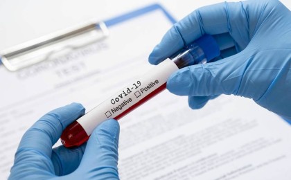 Коронавирус жұқтырған қазақстандықтар саны 1200-ден асты - Қазақстан жаңалықтары