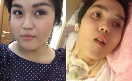 Төсекке таңылған қыздың анасы: Аяғымен барған баланы қолға көтеріп келдік