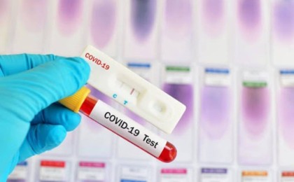 Қазақстандағы коронавирус бойынша соңғы мәліметтер