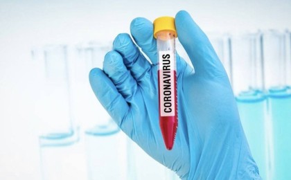 Қазақстанда тағы 255 адамнан коронавирус табылды - Қазақстан жаңалықтары