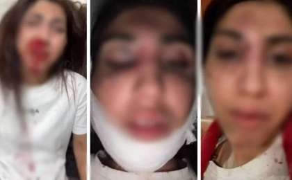 Балаларының көзінше жағы мен мұрнын сындырған: Бұрынғы күйеуінен таяқ жеген әйел Президенттен көмек сұрады