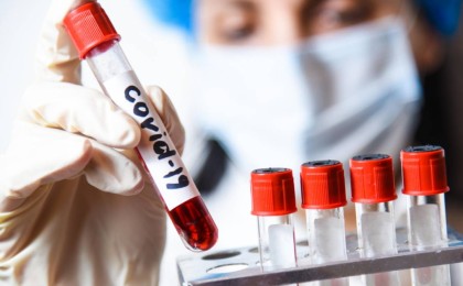 Жалған ПТР тест: Шетелдік шенеуніктің Асқар Мамаинмен кездесуі күшінен қалды