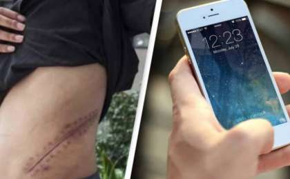 Енді төсек тартып жатыр: Жасөспірім iPhone үшін бүйрегін сатты