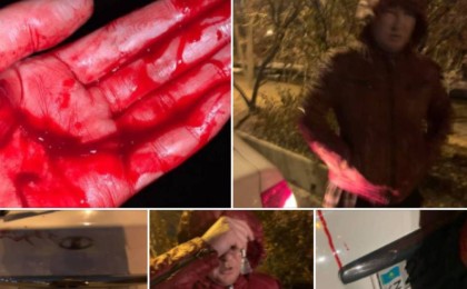 Қолын көтеріп, кесіп тастады: алматылық әйел өзіне шабуыл жасаған такси жүргізушісі туралы айтты