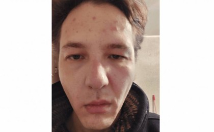 “Тыныш жүр” деп ұрып кетті”: Тәуелсіз журналист Данияр Молдабековке шабуыл жасалды