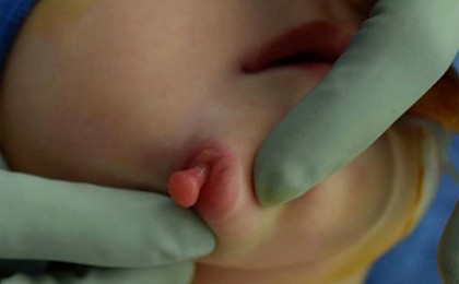 Екі ауызы мен екі тілі бар қыз дүниеге келді - Қазақстан жаңалықтары