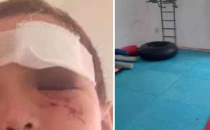 Оралда бес жасар бала MMA үйірмесіндегі қайғылы жағдайдан кейін бір көзінен айырылды