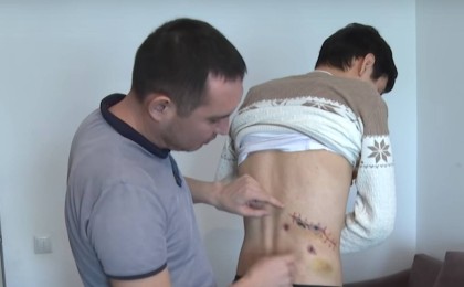 "Үстіне қайнаған су құйған". Жаралы жігіттің абақтыда көрген азабы