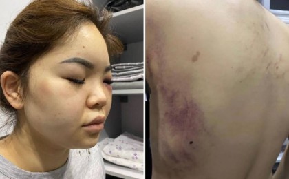 Астаналық әйелді бұрынғы күйеуі оңдырмай сабап тастады