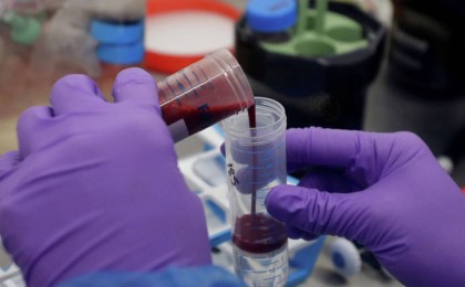 Коронавируспен ауырмаған адамдардан антидене анықталды – ғалымдар себебін айтты