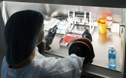 Ғалымдар ескерту жасады: Жарғанаттан адамға қауіпті тағы бір вирус анықталды