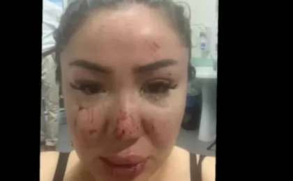 "Барлық дәлелді жариялап, өзімді өлтіремін": Желіде Әнару Құрманәлиева тосын мәлімдеме жасады