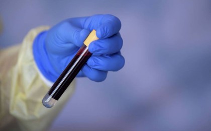 Президент дәрігерлер үшін қылмыстық жазаны өзгертуді ұсынды