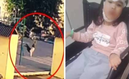 "Бас сүйегі мен жағы сынған": Астанада 6 жасар қыз әткеншектен оңбай құлады