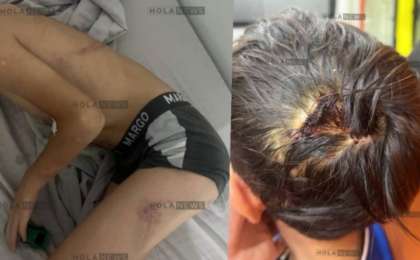 «Қазақмыс» қызметкері азаптаған 8 жасар баланың анасы көмек сұрады