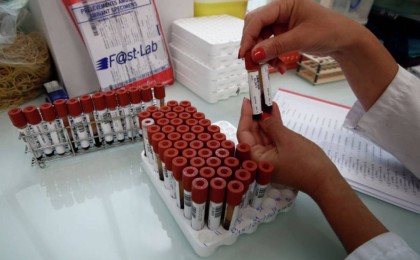 Роспотребнадзор ТМД елдері үшін коронавируспен күрес жөнінде кеңес өткізеді