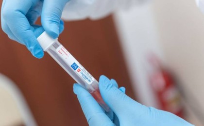 Өткен тәулікте 438 адамнан коронавирус табылды