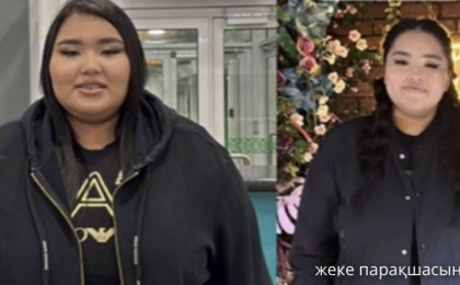 Асқазанына ота жасалған Айшолпан Тілеутай аз уақытта 40 келі салмақ тастады