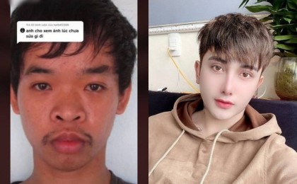 "Ұсқынсыз түріне бола" жұмысқа тұра алмаған жігіт отадан кейін танымастай өзгеріп кетті (фото)