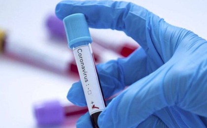 Қарағанды ​​облысында коронавирустың өршуі: жұқтырғандар жайлы не белгілі - Қазақстан жаңалықтары