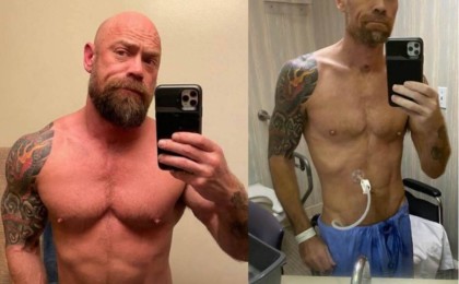 Медқызметкер коронавирустан кейін күрт өзгерген денесін көрсетті - Қазақстан жаңалықтары