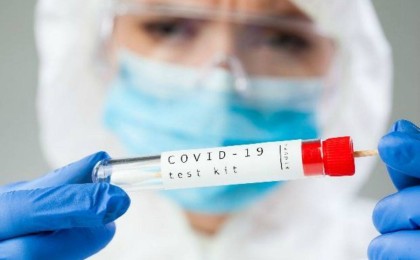 COVID-19-дың адамға жұғуының ерекше жағдайы тіркелді - Қазақстан жаңалықтары