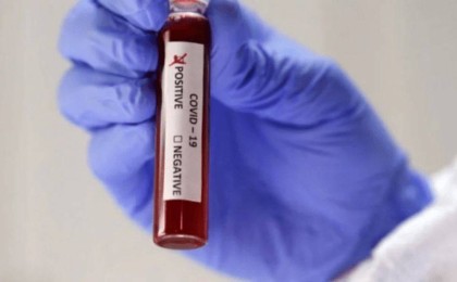 COVID-19-ға тұрақты және ұзақ мерзімді иммунитетке үммітенудің қажеті жоқ - Қазақстан жаңалықтары