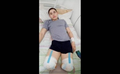 "Өмір мұнымен бітпейді": Қарағандылық студент теміржолдағы оқиға салдарынан аяқсыз қалды