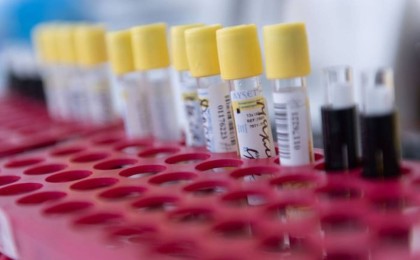 Белгілі құқық қорғаушы Өтебековтің шағымына инфекционист дәрігер жауап берді