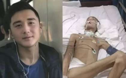 Түркиядан оралған Ербаян Мұхтарды қазақстандық дәрігерлер аяққа тұрғыза ала ма – министрдің жауабы