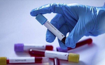 Қазақстандық ғалым мәлімдеме жасады: Пандемия қашан аяқталады?