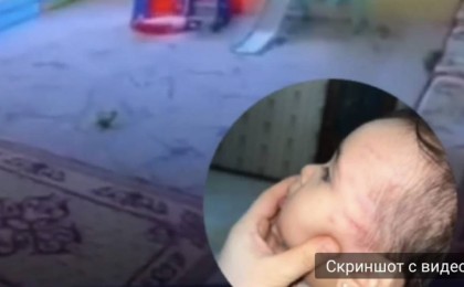 Балабақшаға екі күн барған сәбиді қызметкер ұрып тастаған (видео)
