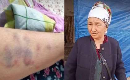 «Балам мен келінім аяусыз ұрып-соғады»: Туған ұлынан зәбір көрген қарт әжей көпшіліктен көмек сұрады (ВИДЕО)