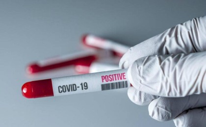 Қазақстанда тағы 154 адам коронавирус жұқтырды - Қазақстан жаңалықтары