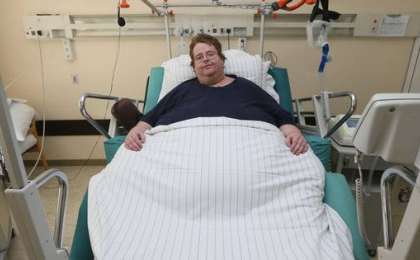 Әуретті жерін байқамаған: Дәрігерлер ер адамға кесар тілігін жасап тастады (фото)