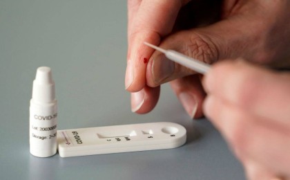 Денсаулық сақтау министрлігі коронавирусқа жасалатын қазақстандық сынақтардың дәлдігін атады - Қазақстан жаңалықтары