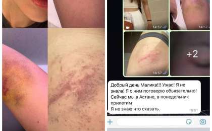 "Соққыға жығып, соңынан аңдыған": Алматылық қызды ұрып-соққан әкімдік қызметкері жұмысынан босатылды