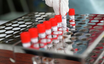 Қазақстанда бірден 138 адамның инфекция жұқтырғаны хабарланды