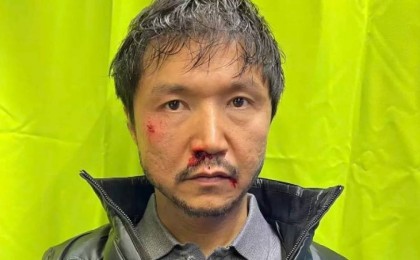 Бет-аузы қан жоса болған Бағлан Әбдірайымовтың суреті жұртты шошытты (фото, видео)