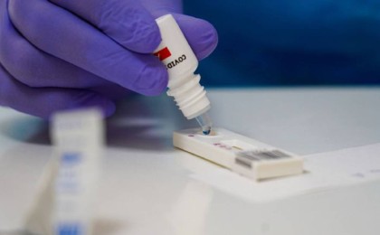 Есмағамбетова отандық тест қашан қолданысқа шығатынын айтты