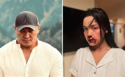 Режиссер Жігер Ауыпбаевқа "Ақботаны зорлайсың" деген талап қойған