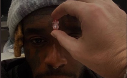 Ақшасын 4 жыл бойы төлеген. Танымал рэпер маңдайына 24 млн доллар тұратын гауһартас орнатпақ