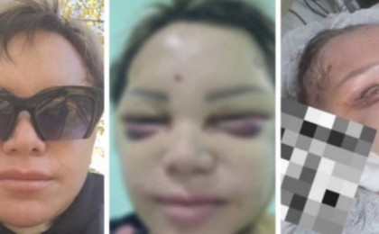 Сұлулық салонына барған көкшетаулық тұрғын мерт бола жаздаған