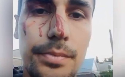 Тоқаевқа шындықты айтқан жігітті әкімдік қызметкерлері соққыға жыққан (ВИДЕО)