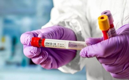 Covid-19 жұқтырғандар саны аяқ астынан артты: жұқтырғандар 179 адам