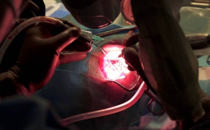 Пәтердегі жөндеу жұмыстары мен құлаққа жасалатын операциялардың арасында қандай ұқсастық бар?