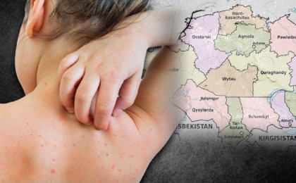 «Ата-аналар балаларына екпе салғызбай отыр»: Қызылша жұқтырғандар саны 30 мыңнан асты